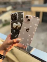 قاب پاپیون لاکچری آیفون و سامسونگ و شیائومی (کدC1935) - تصویر 8